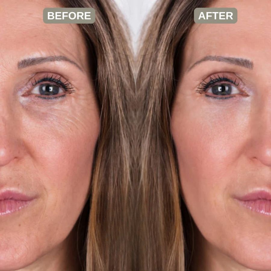 Retinal Skin Tightening Booster