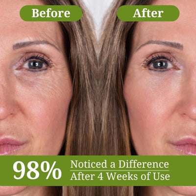 Retinal Tightener™